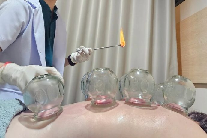 5 สัญญาณที่ร่างกายต้องการครอบแก้ว