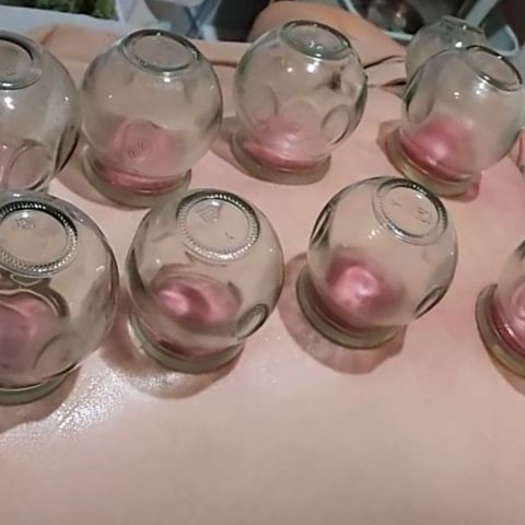 Réla TCM clinic - ครอบแก้ว